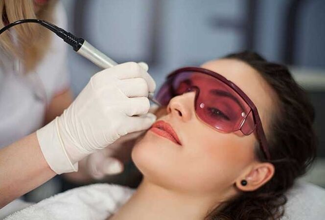 Biorévitalisation du laser