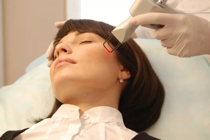 Rajeunissement au laser