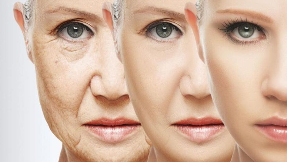 Rajeunissement fractionnaire de la peau si nécessaire