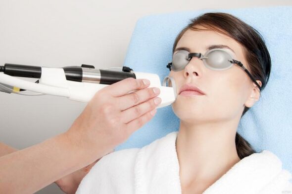 effectuer une procédure de rajeunissement de la peau au laser